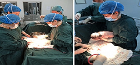 當高危產婦碰上“熊貓血”如何抉擇？