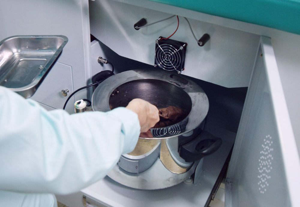 康復(fù)治療70天，偏癱患者步行出院！(圖2)