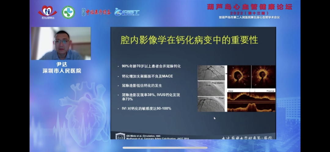 葫蘆島心血管健康論壇?2022｜創(chuàng)新驅(qū)動(dòng)發(fā)展，不斷提升心血管疾病救治能力(圖11)